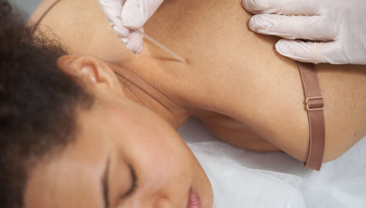 Ancient Wisdom, Modern Science: Acupuncture